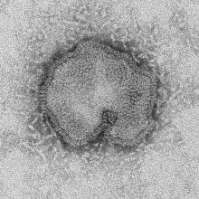 Spherical influenza A H7N9 virus as viewed through an electron microscope.